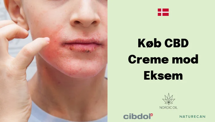 CBD Creme mod Eksem