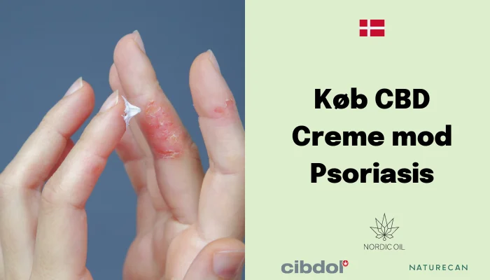 CBD Creme mod Psoriasis